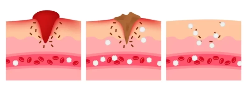 BRUNOVASSARI CLEANSING GEL جل تنظيف يعالج عيوب البشرة تنظيف عميق للبثور و حب الشباب و الرؤوس السوداء