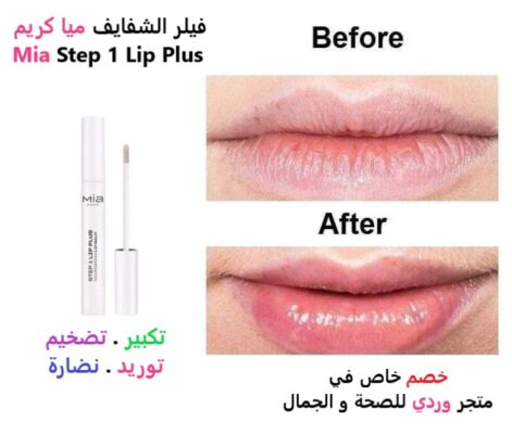 فيلر الشفايف ميا كريم Mia Step 1 Lip