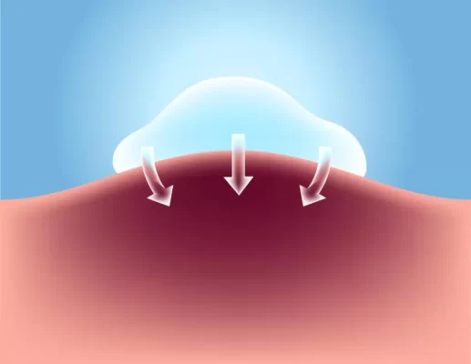  هيكوم جيل مستخلص عشبي يُستخدم في العلاج الموضعي للجروح السطحية والحروق واللسعات والحكةوهو جل منعش ومهدئ للغاية يجدد الجلد ويدعم استجابة الجسم الطبيعية للعدوى