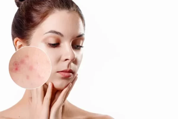 COSMETIC SKINSOLUTIONS RETINOL كريم ليلي عالي التركيز من فيتامين أ مصمم لعكس علامات الشيخوخة. يساعد على تجديد خلايا الجلد، وتحسين البقع، وتقليل الخطوط الدقيقة والتجاعيد.