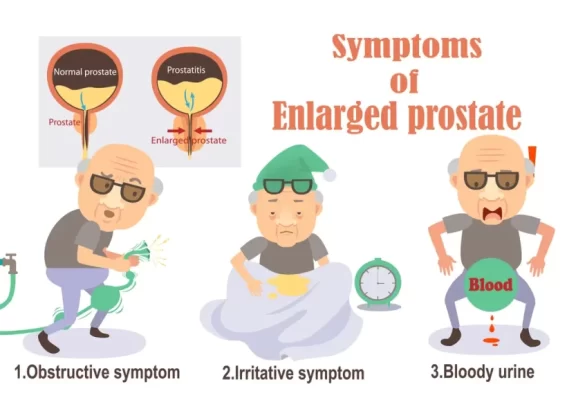 تضخم البروستاتا و اعراضة خاصة علي كبار السن