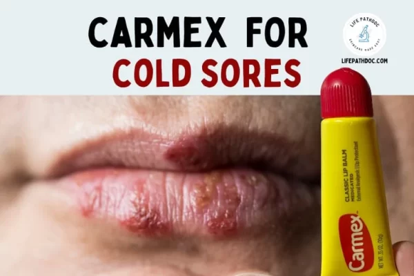 carmex مرطب شفاه كارمكس كلاسيك 10 جرام classic